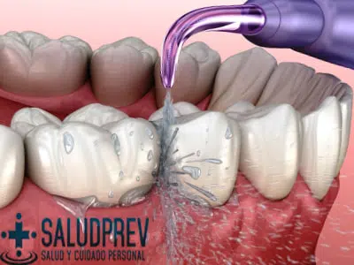 Cómo funciona un irrigador bucal